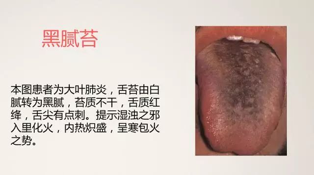 The Most Comprehensive TCM Tongue Diagnosis Atlas: Observe the Tongue, Understand the Whole Body!