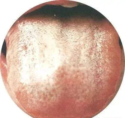 130 High-Definition Tongue Diagnosis Charts (Recommended for Collection)