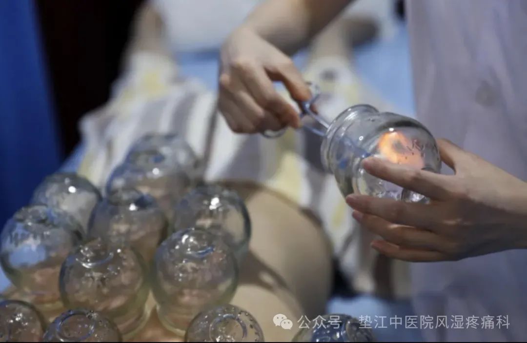 Traditional Chinese Medicine Techniques — Cupping Therapy