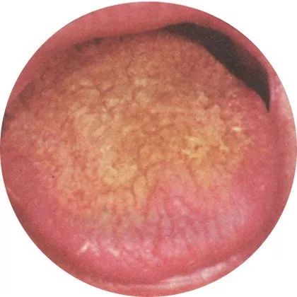 The Most Comprehensive High-Definition Real Tongue Diagnosis: Observing Tongue Patterns to Understand Internal Organs (Collection Edition)