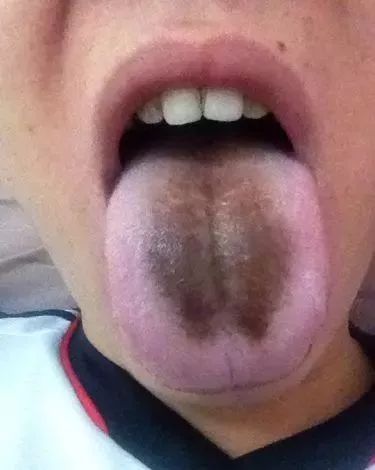 The TCM Tongue Diagnosis Atlas is Here! Observe the Tongue to Understand the Whole Body!