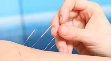 Understanding Acupuncture in Traditional Chinese Medicine