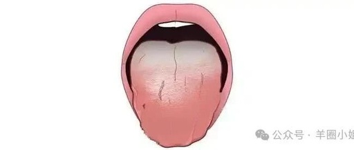 Is a Thick Coating on the Tongue Your Body's Alarm? A Practical Guide to Understanding Tongue Coating
