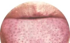 130 High-Definition Tongue Diagnosis Charts (Recommended for Collection)
