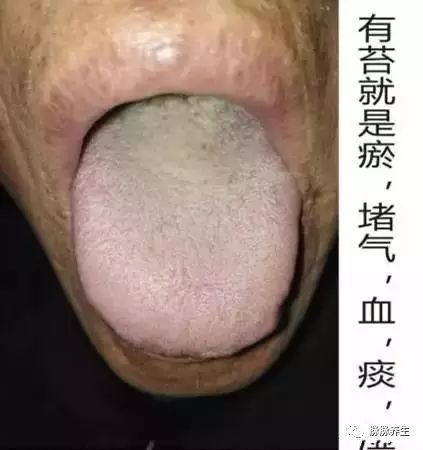 Tongue Diagnosis: A Clear Insight