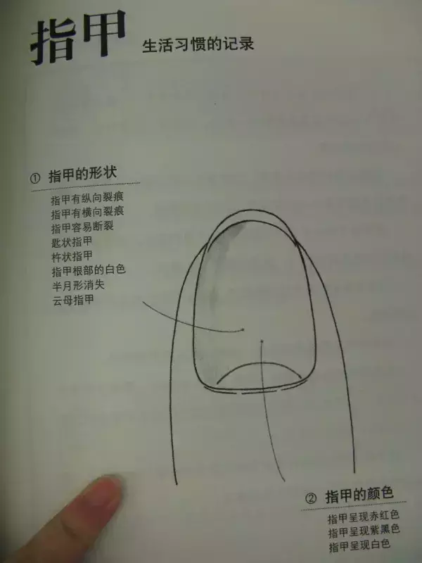 Essence of TCM Observation Diagnosis Illustrated