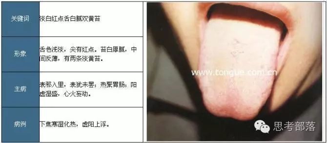 Comprehensive Guide to Tongue Diagnosis (8): 72 Types of Tongue Diagnosis Charts