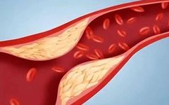 Traditional Chinese Medicine: Enlarged Tongue, Purple-Dark Tongue Body with Teeth Marks? It's Not Just Spleen Deficiency!