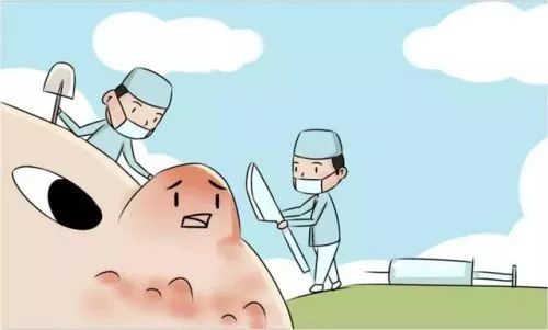 Fire Needle Therapy: Alleviating Pain for Skin Disease Patients