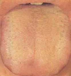 62 High-Definition Tongue Diagnosis Charts with Illustrations (Collector's Edition)