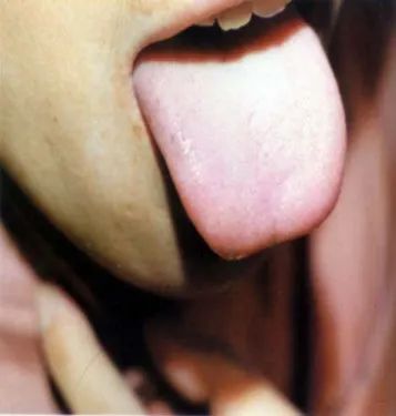 The Health Code Hidden on Your Tongue