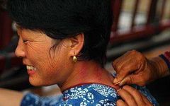 10 Gua Sha Techniques to Relieve Various Ailments Using a Spoon