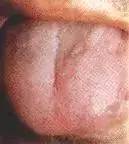 Comprehensive Guide to Tongue Diagnosis: Learn How Your Tongue Reflects Your Health!