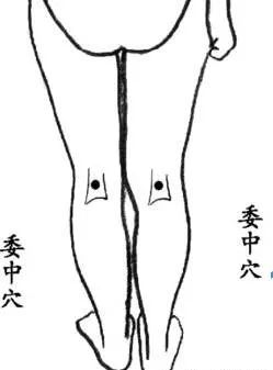The Therapeutic Effects of Bloodletting in Traditional Chinese Medicine