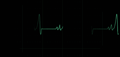 Ni Haixia: A Detailed Explanation of the Operational Patterns of the Five Zang and Six Fu Organs That Everyone Should Understand