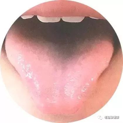 Learn Quick Ways to Observe Tongue Quality and Coating to Understand Your Health and Diseases!