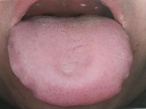 The Health Code Hidden on Your Tongue