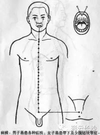 Classic Acupuncture Points: The Eight Extraordinary Meridians