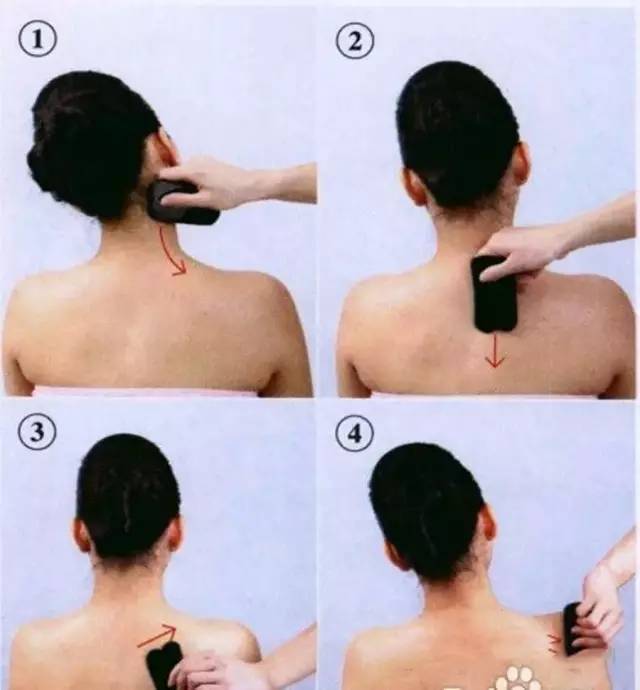Benefits and Effects of Gua Sha on the Shoulders and Neck