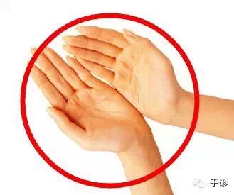 Eight Principles of Hand Diagnosis Based on Color Observation (Must-Collect)