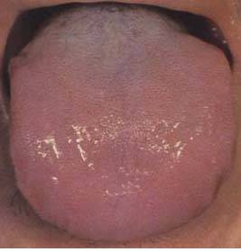 62 High-Definition Tongue Diagnosis Charts with Illustrations (Collector's Edition)