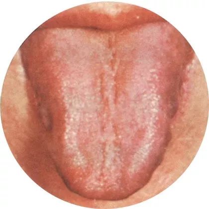 The Most Comprehensive High-Definition Real Tongue Diagnosis: Observing Tongue Patterns to Understand Internal Organs (Collection Edition)