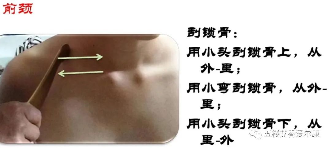 Summary of Common Diseases and Gua Sha Treatment Plans Including Human Reflex Maps, Contraindications, and Diagnosis of Sha Patterns