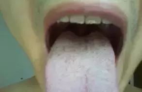 The Most Comprehensive Guide to Tongue Diagnosis! Master It and Become a Tongue Diagnosis Expert