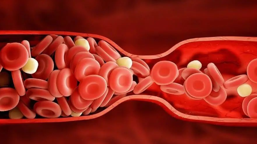 Unblocking Blood Stasis for Overall Wellness: 4 Chinese Patent Medicines for Circulation