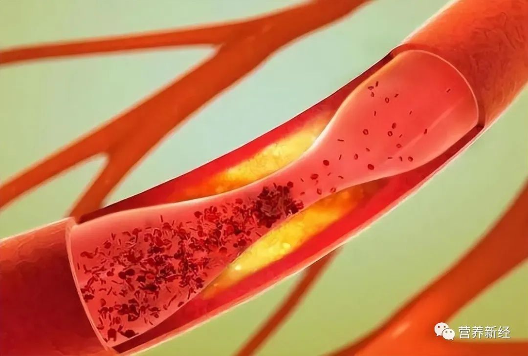 Traditional Chinese Medicine: Blood Stasis Causes Spots, Improve Blood Stasis Constitution by Regularly Consuming These 7 Ingredients