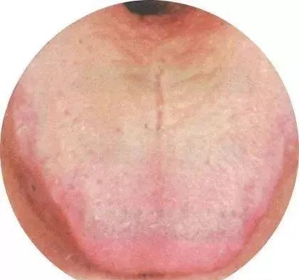130 High-Definition Tongue Diagnosis Charts (Recommended for Collection)