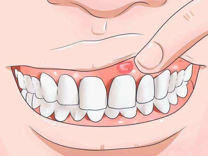 Cold Weather Triggers Stomach Issues: A Formula to Warm the Spleen and Stomach