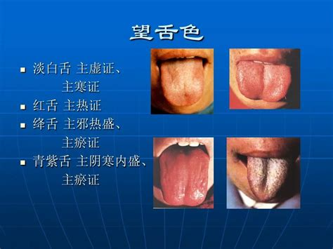 A Comprehensive Guide to Tongue Diagnosis in Traditional Chinese Medicine