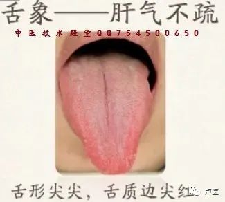 Exploring Tongue Diagnosis in Traditional Chinese Medicine: Hidden Insights and Tongue Diagnosis Atlas