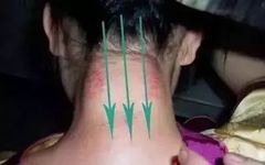 Specific Gua Sha Techniques for the Whole Body: Please Remember!