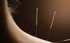 Understanding Acupuncture: Debunking Myths and Exploring Mechanisms