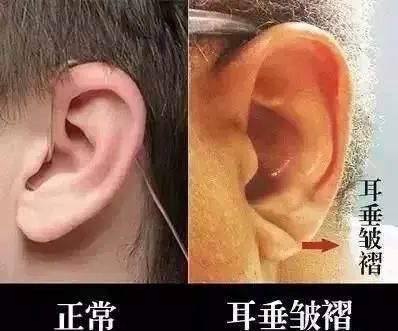 The Mastery of Traditional Chinese Medicine: Observation Diagnosis, Knowing by Observation is Divine!