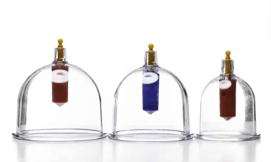 Cupping Therapy: Not Everyone Should Try It! 7 Situations to Avoid
