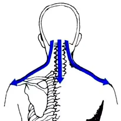 Comprehensive Gua Sha Therapy for Different Types of Colds in Traditional Chinese Medicine