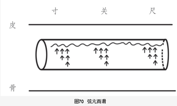 Understanding the Xian Pulse in Traditional Chinese Medicine