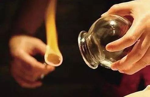 The Marvelous Cupping Therapy in Traditional Chinese Medicine: Many Benefits, but Not for Everyone!