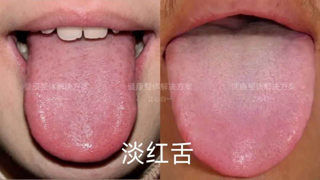 Observing the Tongue for Health: How to Analyze Tongue Quality?