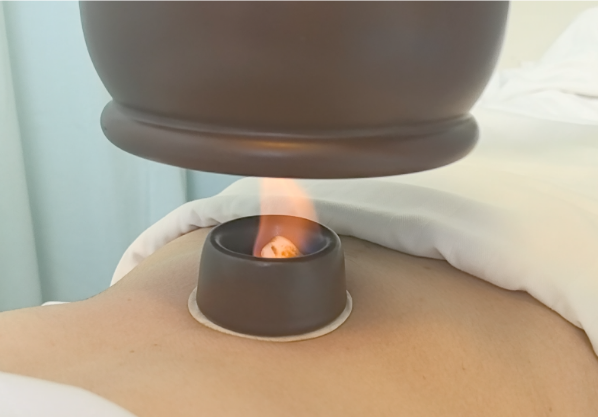 Warming Yang Cupping: Balancing Yin and Yang to Prevent Autumn Dryness