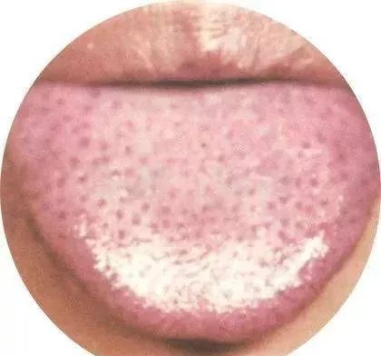 130 High-Definition Tongue Diagnosis Charts (Recommended for Collection)
