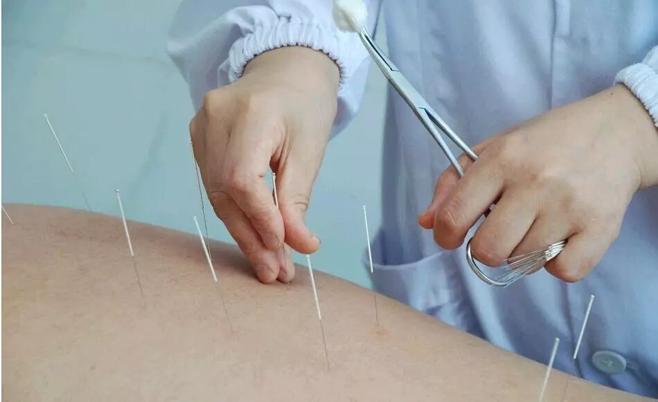 Gua Sha, Massage, and Bloodletting: A Cautionary Tale from Nanning