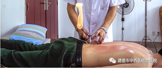 Cupping Therapy in Summer: An Effective Method to Eliminate Dampness, Relieve Heat, and Drive Away Cold