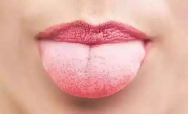 Comprehensive Tongue Diagnosis Guide! TCM Teaches You 6 Methods to Understand Health Through Your Tongue, Save for Future Reference!