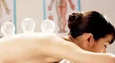 A Man Gets Stuck with a Cupping Jar at Home, Firefighters Help Cut It Off... Do You Really Understand Cupping?