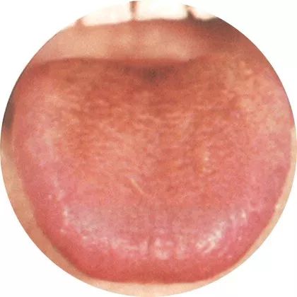 The Most Comprehensive High-Definition Real Tongue Diagnosis: Observing Tongue Patterns to Understand Internal Organs (Collection Edition)