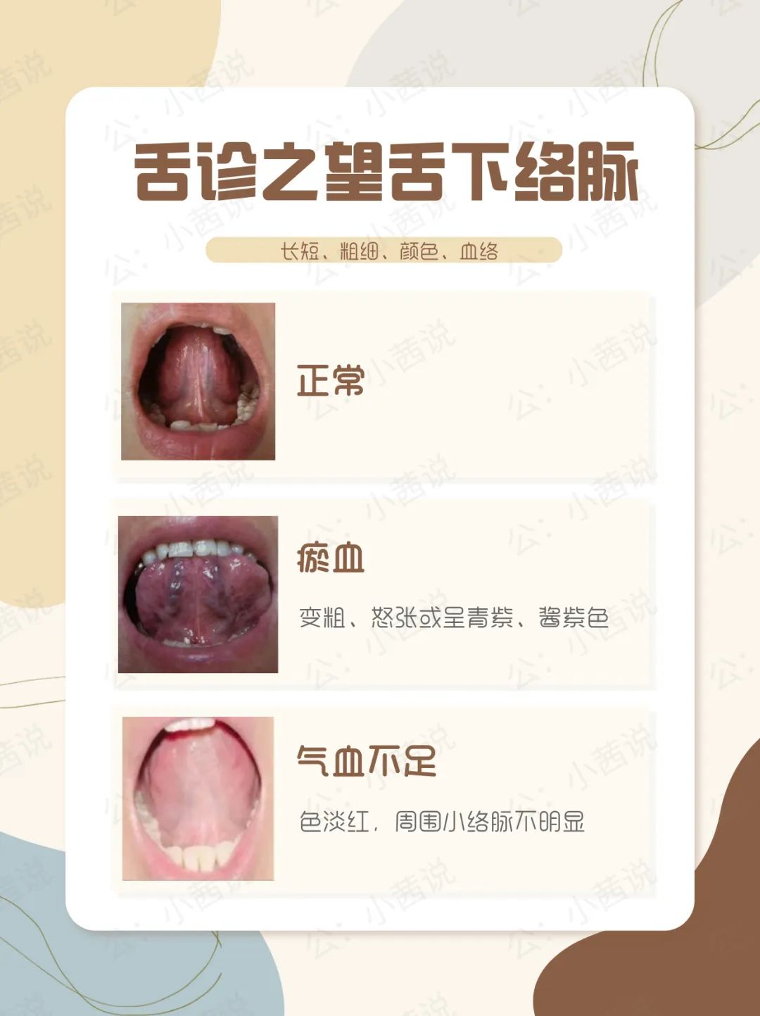 Observing the Sublingual Collaterals